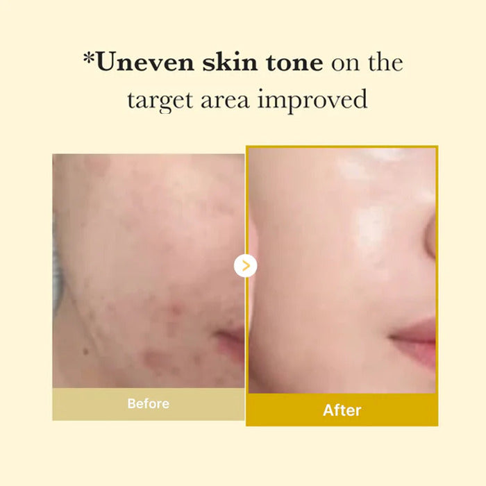 Kojic Acid Turmeric Night Wrapping Mask