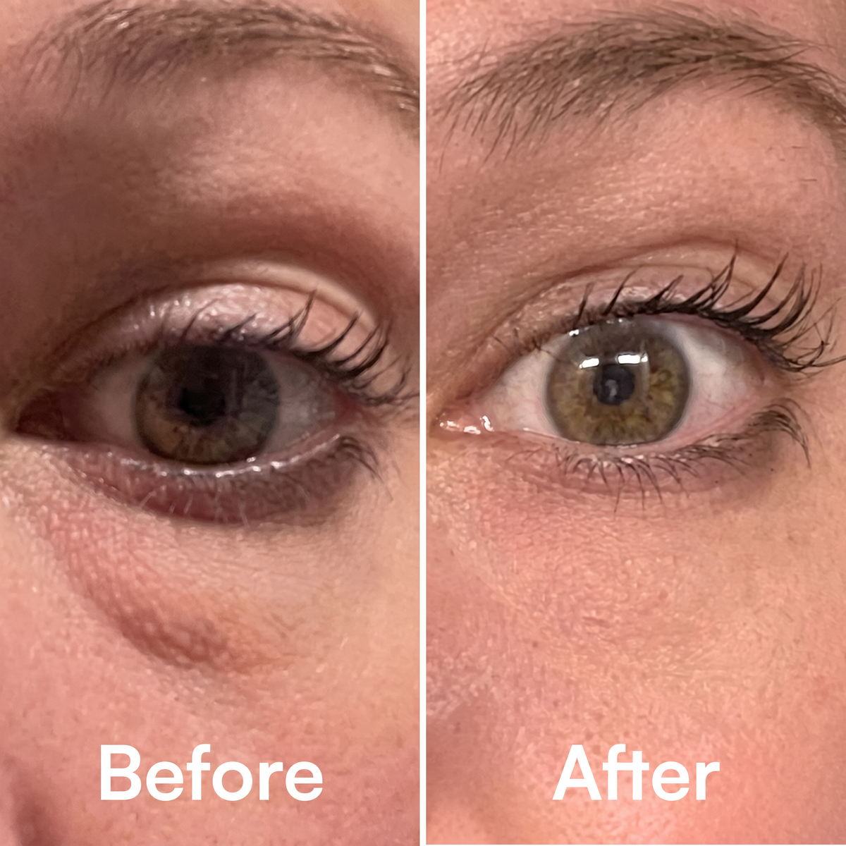 QUIA Retinol Eye Patches