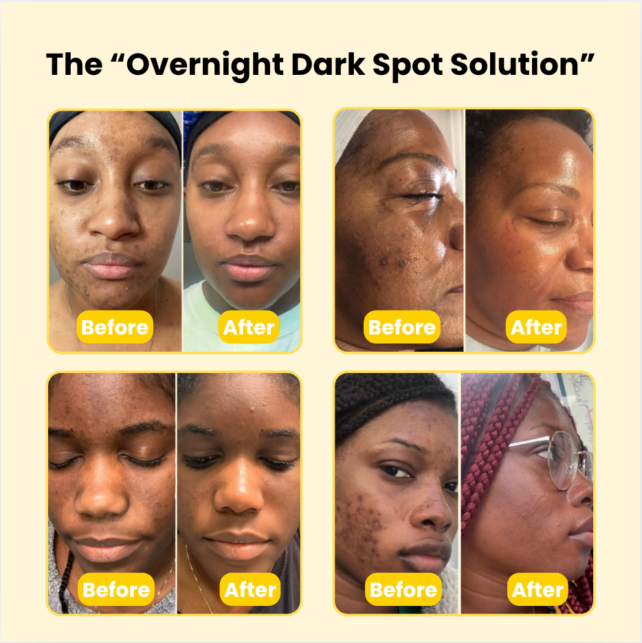 Kojic Acid Turmeric Night Wrapping Mask