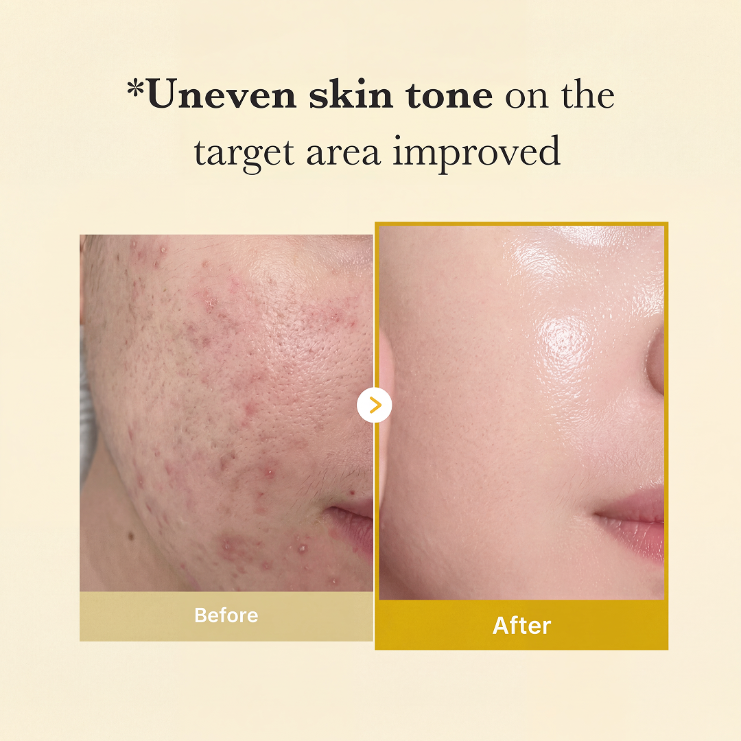 Kojic Acid Turmeric Night Wrapping Mask