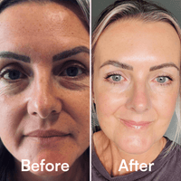 QUIA Calcium Balm - Quia Korean Beauty