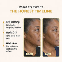 Quia Turmeric & Kojic Acid Overnight Mask - Quia Korean Beauty