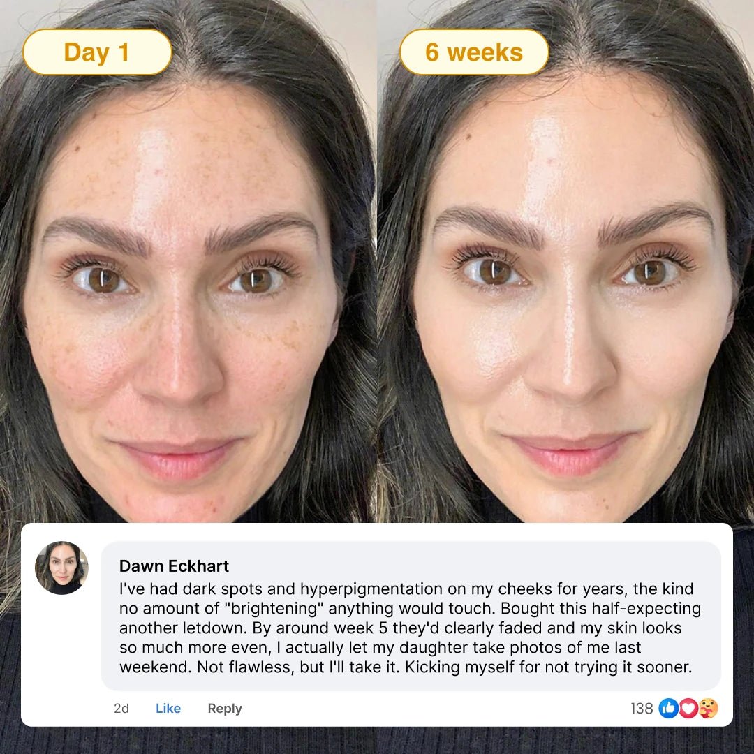 Quia Turmeric & Kojic Acid Overnight Mask - Quia Korean Beauty
