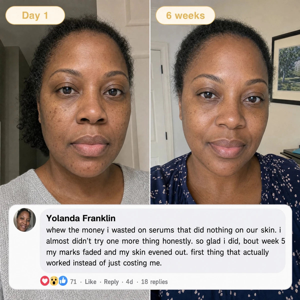 Quia Turmeric & Kojic Acid Overnight Mask - Quia Korean Beauty
